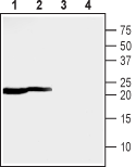 Anti-MMGT1 Antibody