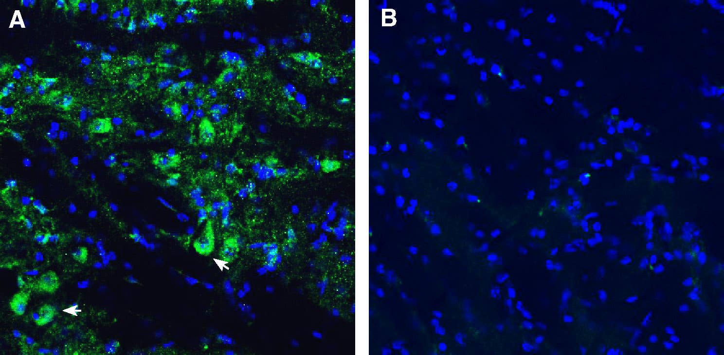 Anti-SLC10A4 (extracellular) Antibody