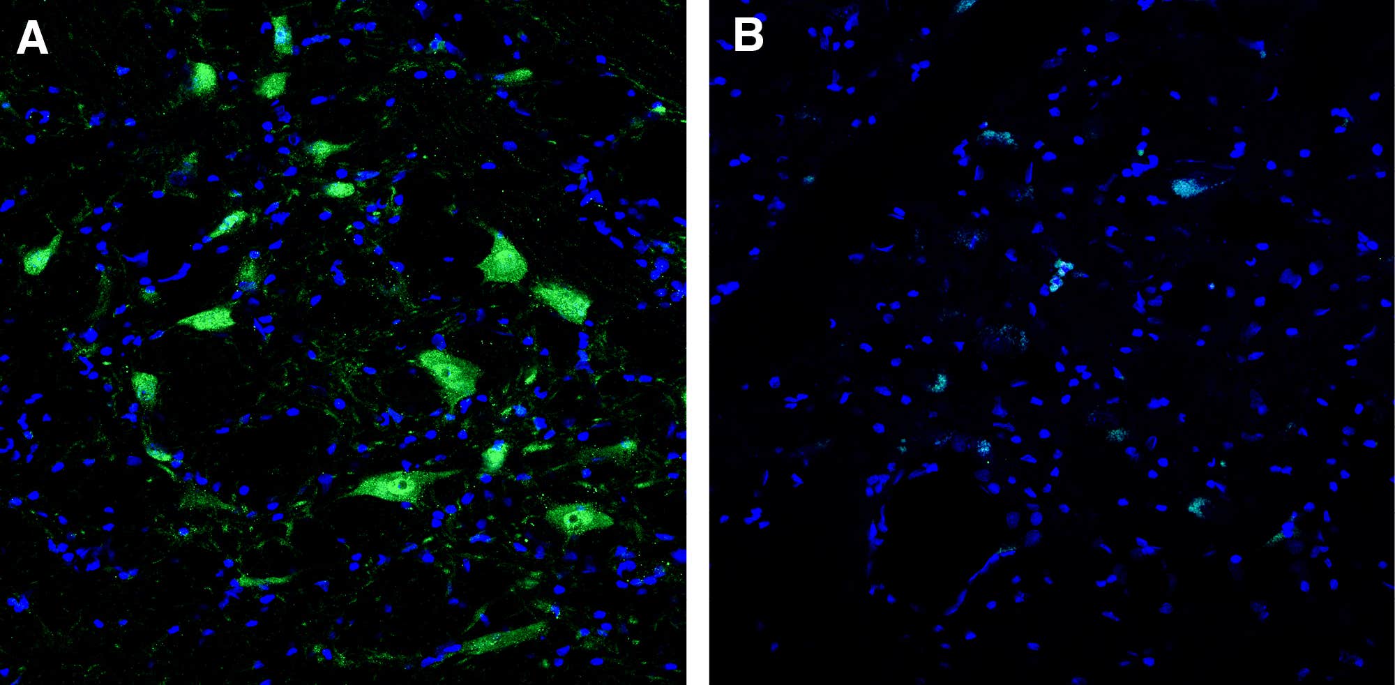 Anti-LETM1 Antibody