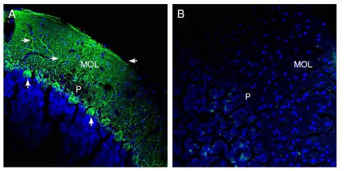 Anti-SLC38A1 Antibody