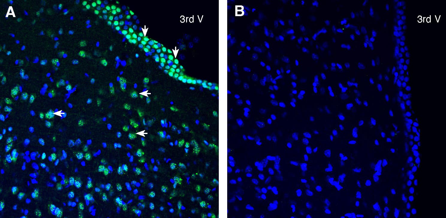 Anti-SLC38A2 (SNAT2) Antibody