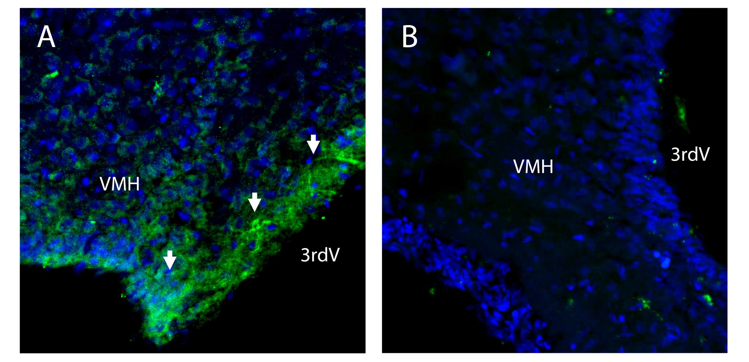 Anti-CAT-1 (SLC7A1) (extracellular) Antibody