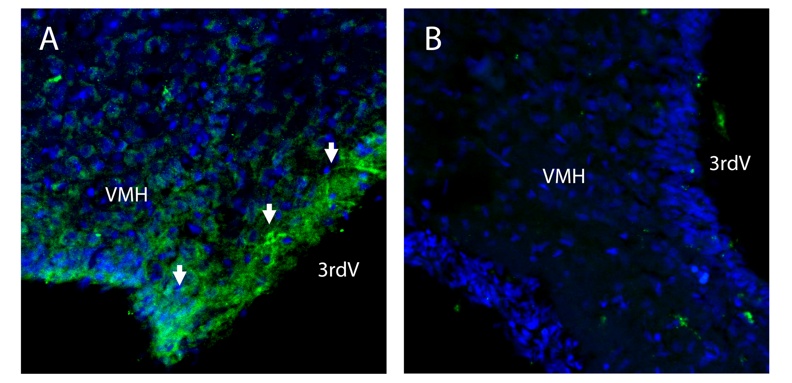CAT-1 (SLC7A1) (extracellular) Blocking Peptide