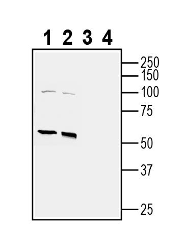 CAT-1 (SLC7A1) (extracellular) Blocking Peptide