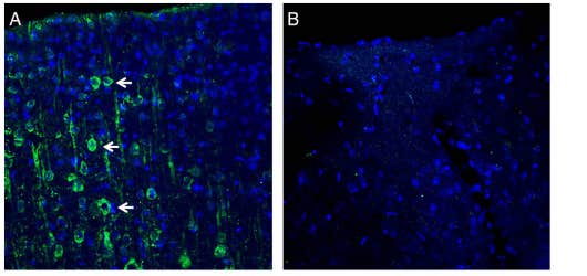 Anti-MAGT1 (extracellular) Antibody