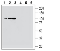 MAGT1 (extracellular) Blocking Peptide