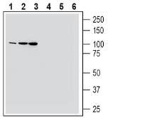 MAGT1 (extracellular) Blocking Peptide