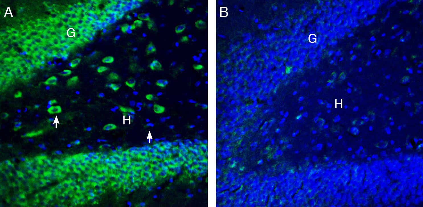 Anti-SLC11A1/NRAMP1 (extracellular) Antibody