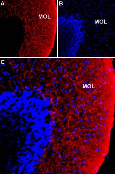 Anti-NKCC1 (SLC12A2) Antibody