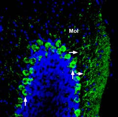 Anti-ADAM22 (extracellular) Antibody