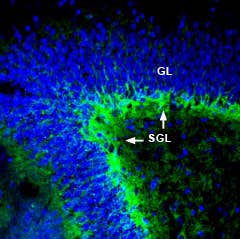 Anti-ASCT1 (SLC1A4) Antibody