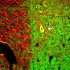 Anti-Neurotrophin 3 (NT-3) Antibody