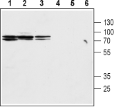 Na+/H+ Exchanger 2/NHE-2 Blocking Peptide