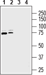 Na+/H+ Exchanger 6/NHE-6 Blocking Peptide