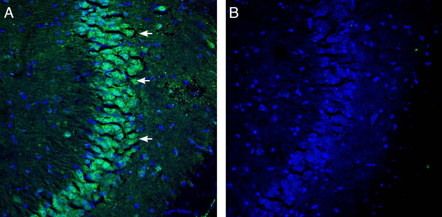 Anti-Na<sup>+</sup>/H<sup>+</sup> Exchanger 7 (NHE7) (extracellular) Antibody