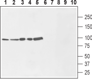 Na+/H+ Exchanger 1/NHE-1 (extracellular) Blocking Peptide
