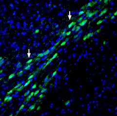 Anti-Na<sup>+</sup>/H<sup>+</sup> Exchanger 1 (NHE-1) (extracellular) Antibody