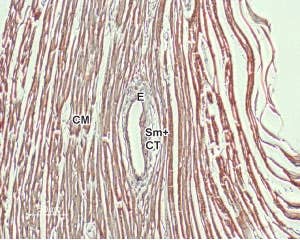 Anti-NCX1 (SLC8A1) Antibody