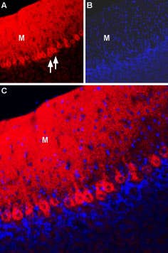 Anti-NCX2 (SLC8A2) Antibody
