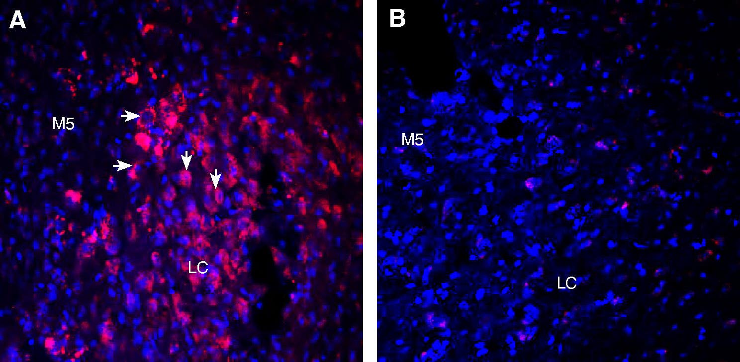 Guinea Pig Anti-Orexin Receptor 1 Antibody