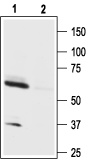 Orexin Receptor 1 Blocking Peptide