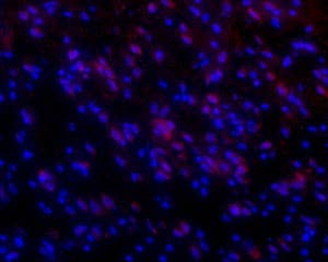Anti-Orexin Receptor 1 Antibody