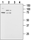 Orexin Receptor 2 Blocking Peptide