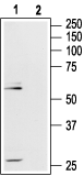 µ-Opioid Receptor/OPRM1 (extracellular) Blocking Peptide