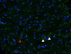 Anti-&micro;-Opioid Receptor (OPRM1) (extracellular) Antibody