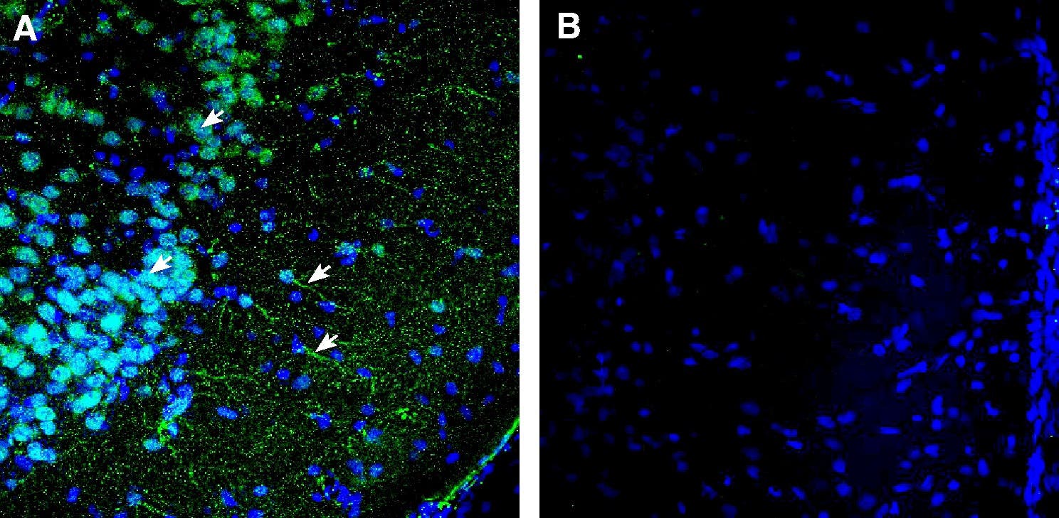 Anti-κ-Opioid Receptor (OPRK1) (extracellular) Antibody