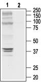 δ-Opioid Receptor/OPRD1 (extracellular) Blocking Peptide