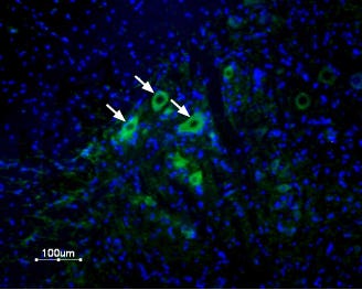 Anti-δ-Opioid Receptor (OPRD1) (extracellular) Antibody
