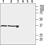OXGR1/GPR99 Blocking Peptide