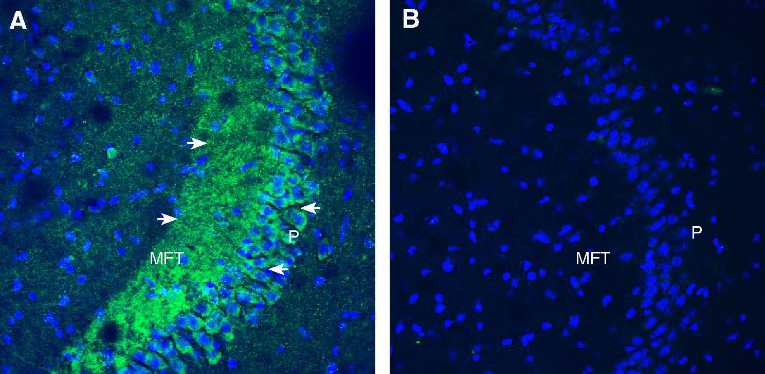 Anti-Opsin 3 (extracellular) Antibody