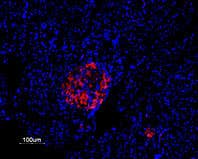 Anti-K<sub>V</sub>2.1 Antibody