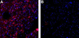 Anti-KCNN3 (K<sub>Ca</sub>2.3, SK3) (N-term)-ATTO Fluor-594 Antibody