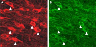Anti-KCNN3 (K<sub>Ca</sub>2.3, SK3) (N-term) Antibody