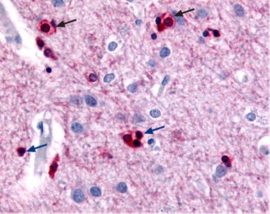 Anti-KCNN2 (K<sub>Ca</sub>2.2, SK2) Antibody