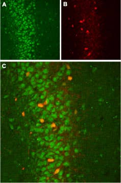 Anti-<em>slo</em>β2 (KCNMB2) Antibody