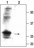 Anti-<em>slo</em>β1 (KCNMB1) Antibody - Carrier Free
