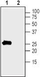 sloβ1/KCNMB1 Blocking Peptide