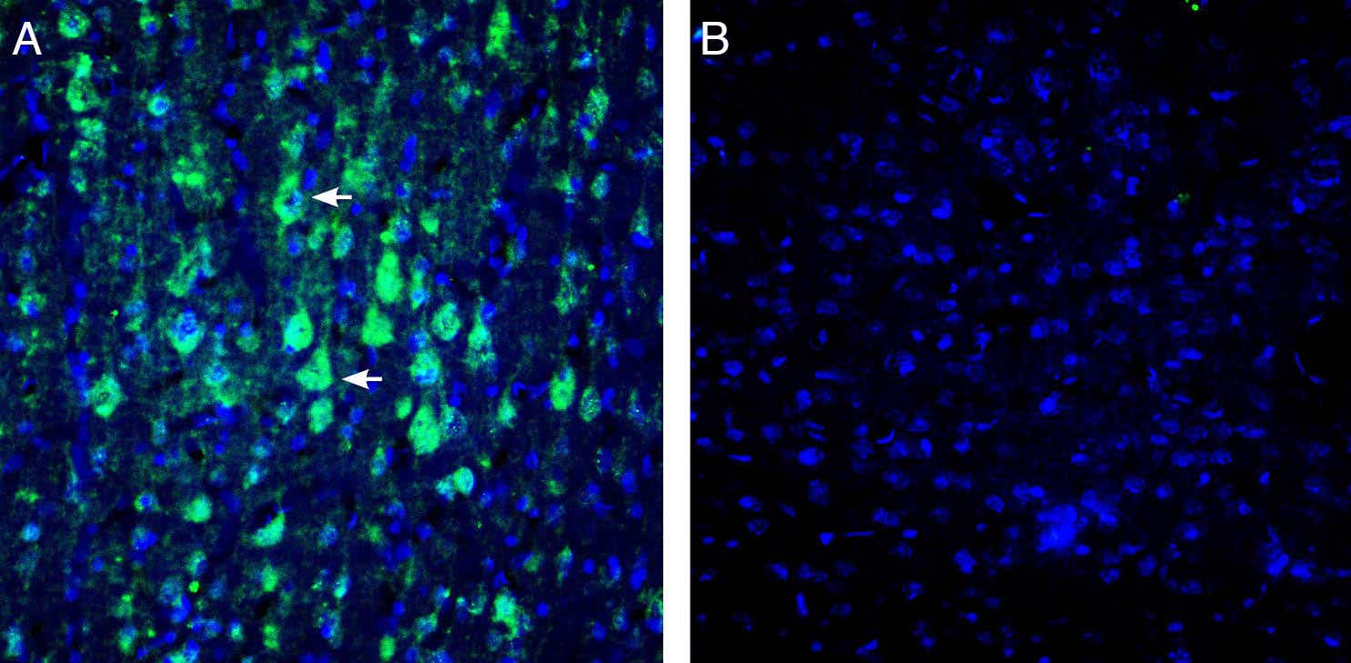 Anti-KCNN1 (K<sub>Ca</sub>2.1, SK1) Antibody