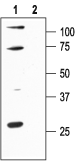 KCNN1/KCa2.1 Blocking Peptide