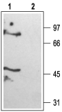 Anti-KCNK6 (TWIK-2) Antibody