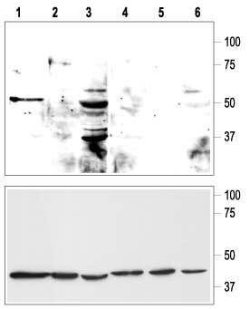 KCNK9/TASK-3 (extracellular) Blocking Peptide