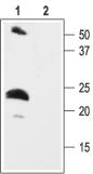Anti-KCNE2 (MiRP1) Antibody - Carrier Free