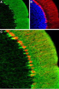 Anti-HCN1 Antibody