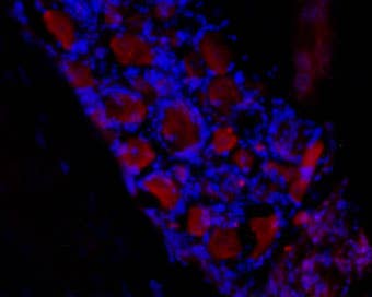 Anti-HCN3 Antibody