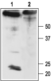 Anti-<em>slo</em>β4 (KCNMB4) Antibody - Carrier Free