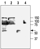 KCNN4/KCa3.1 Blocking Peptide